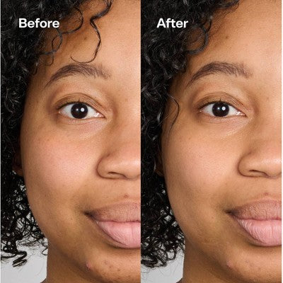 Bubble Skincare Under Cover Color Correcting Balm Dark Spot Fix - 0.5oz