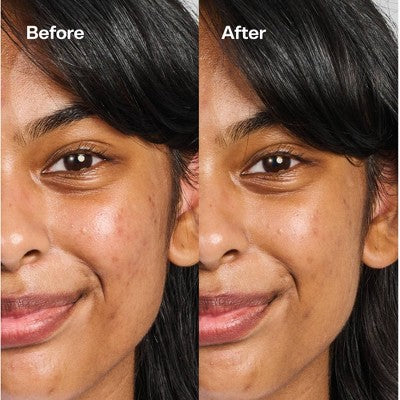 Bubble Skincare Under Cover Color Correcting Balm Dark Spot Fix - 0.5oz