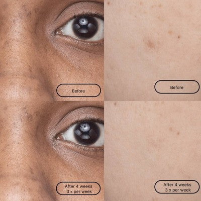 LOOPS Hyper Smooth Dark Spot Treatment Hydrogel Face Mask - 0.19oz