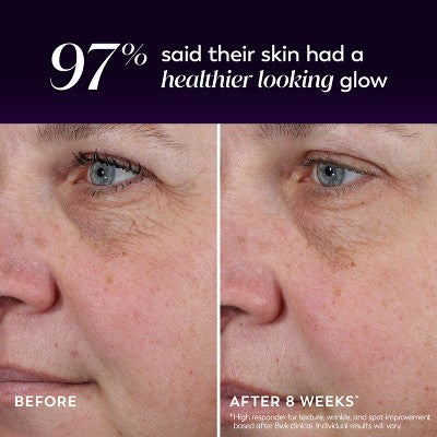 Olay Regenerist Resurfacing Peel Night Treatment - 1 fl oz