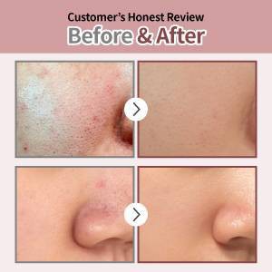 numbuzin No.3 Tingle-Pore Softening Sheet Mask - 0.91 fl oz