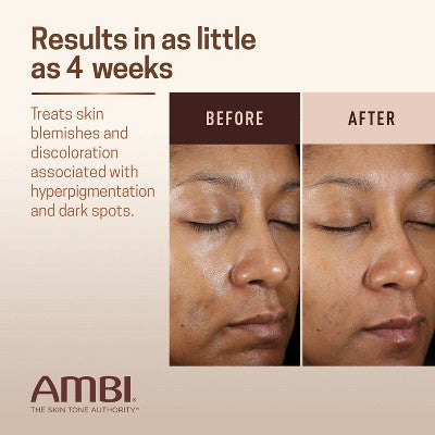 AMBI Even & Clear Fade Cream - Advanced - 1 fl oz