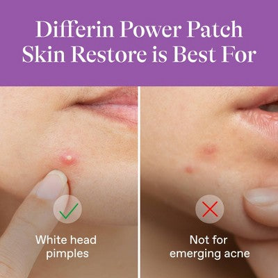 Differin Skin Restore Hydrocolloid Pimple Patches for Acne - 23ct
