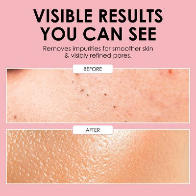 JAPONESQUE Per-Fection Clear Skin Set - 3pc