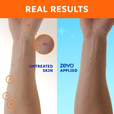 Zevo On Body Mosquito + Tick Repellent Bug Spray Value - 7.8oz Lotion