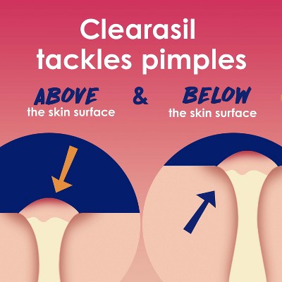 Clearasil Rapid Rescue Deep Treatment Pads - 90ct