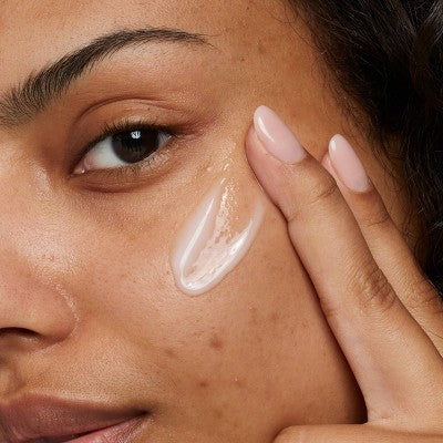 No7 Derm Solutions Daily Lightweight Moisturiser - Oily and Blemish Prone Skin - 3oz